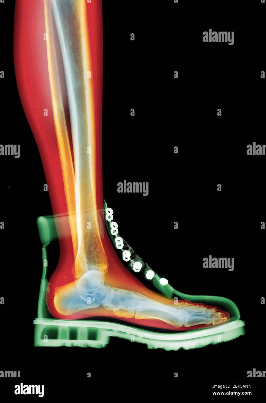 Lace-up boot, coloured MRI style X-ray. Stock Photo