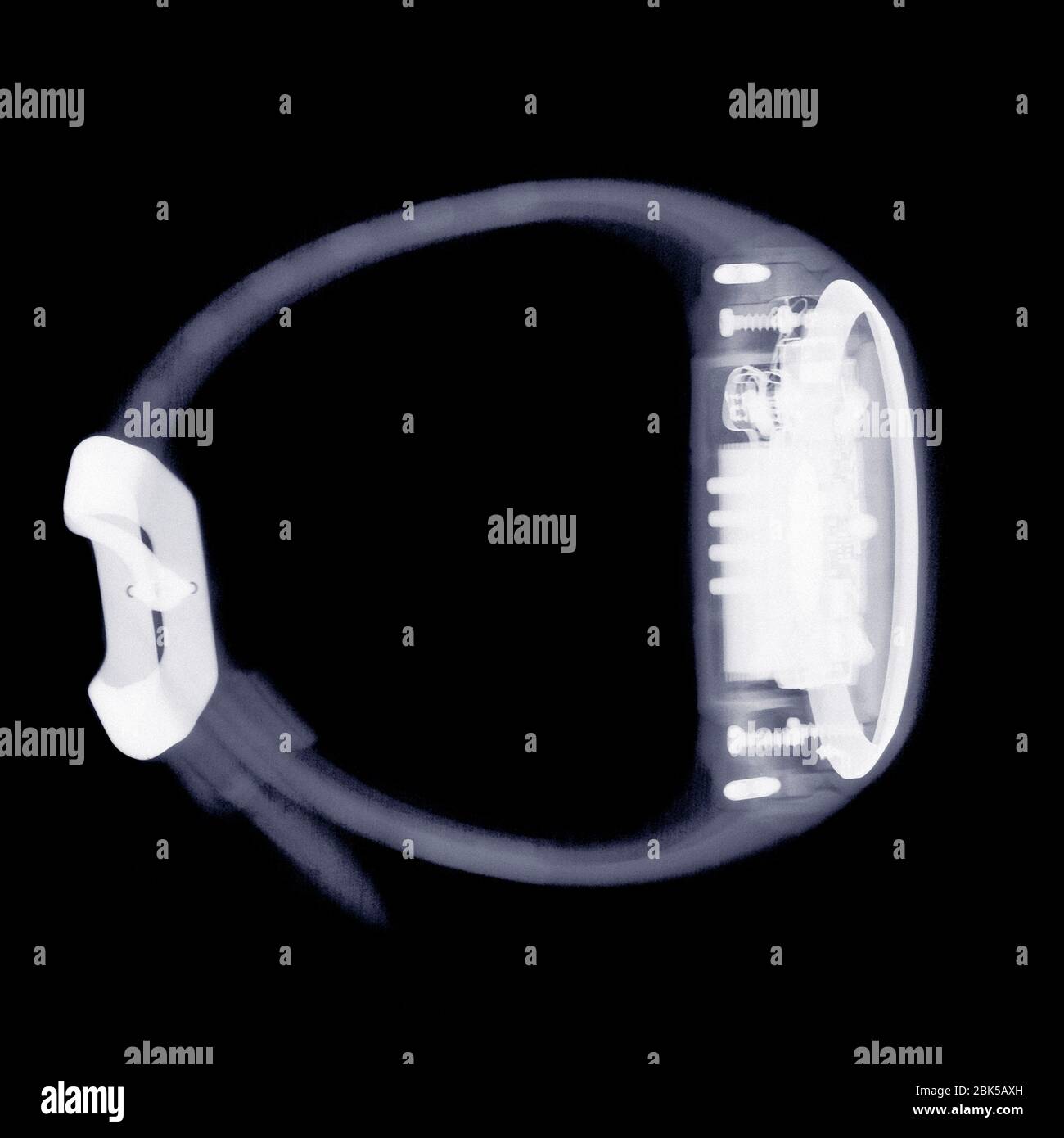 Watch and strap, X-ray. Stock Photo