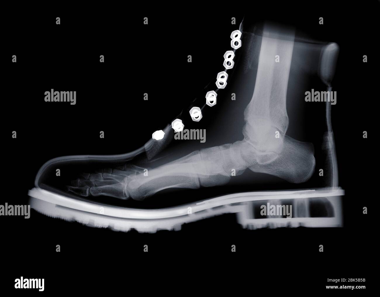 Human foot inside boot, X-ray. Stock Photo