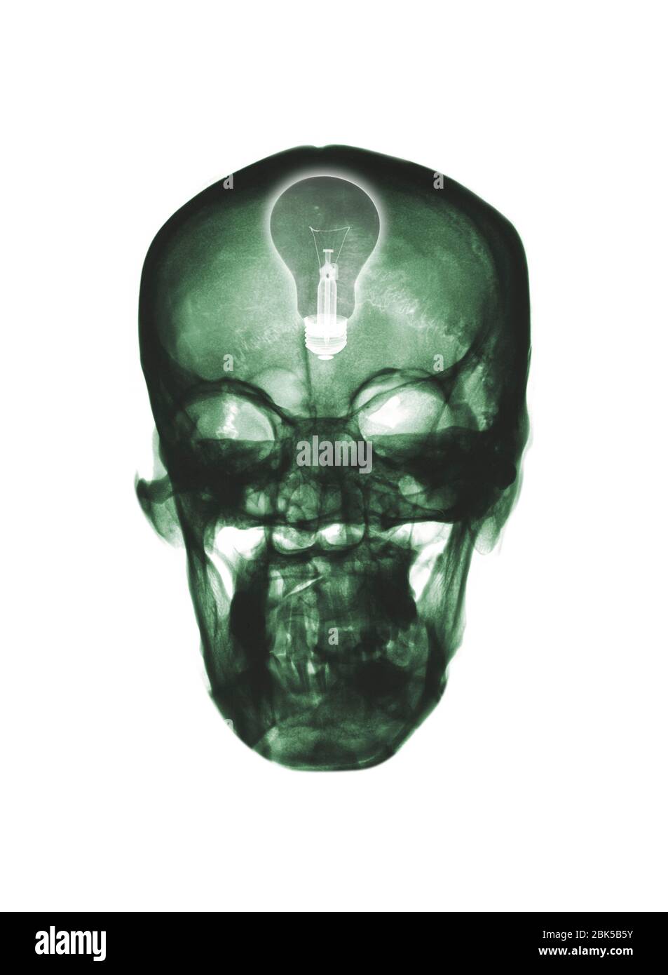 X ray light bulb Cut Out Stock Images & Pictures Alamy