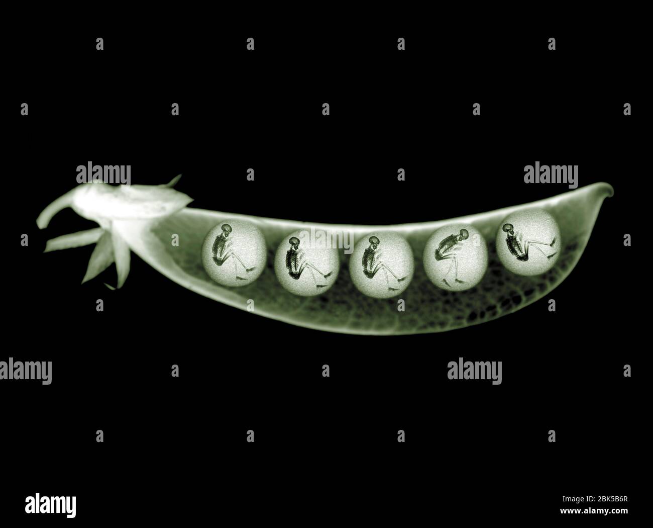 Peas in a pod with skeletons, X-ray. Stock Photo