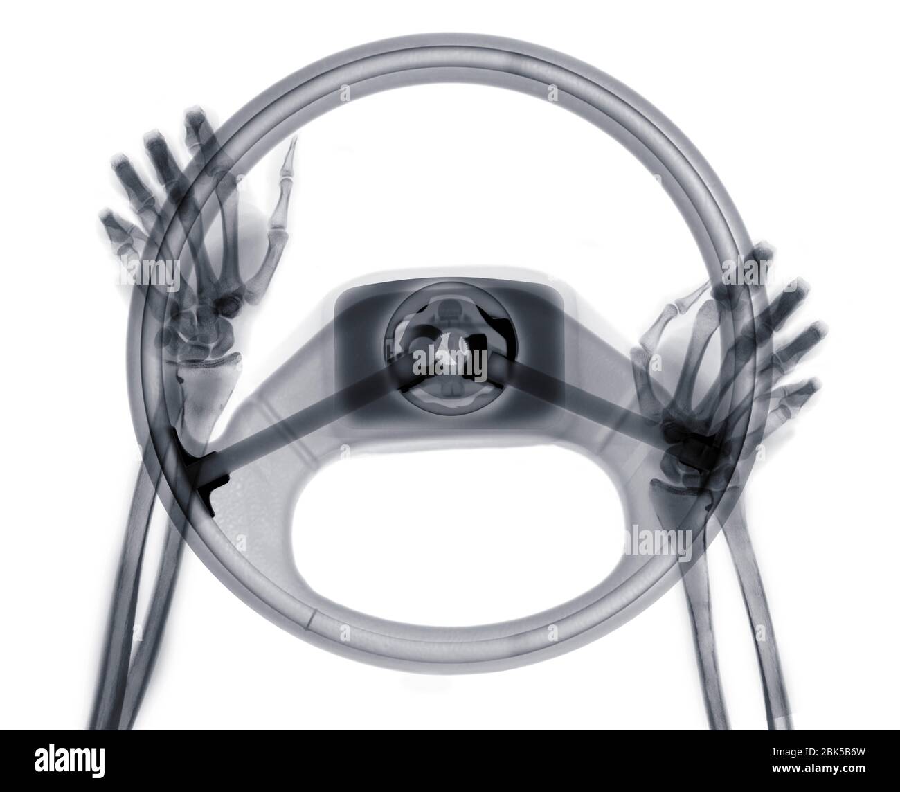 Human hands on steering wheel, X-ray. Stock Photo