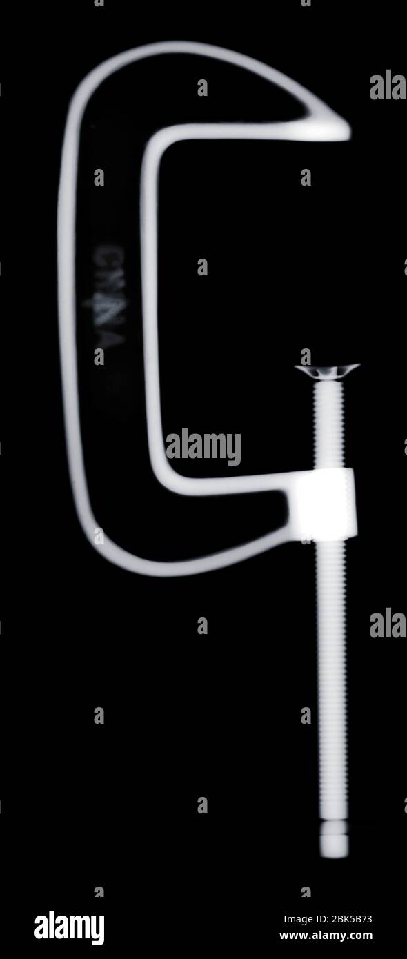 C clamp, X-ray. Stock Photo