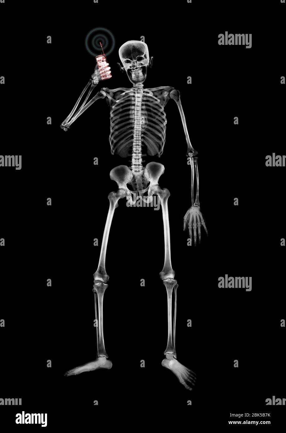 Human skeleton answering mobile phone, X-ray. Stock Photo