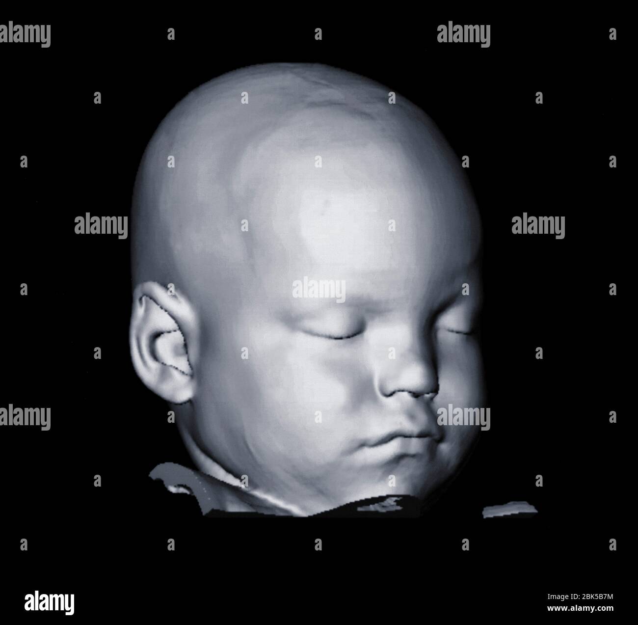 Image of baby's head, computed tomography (CT) scan. Stock Photo