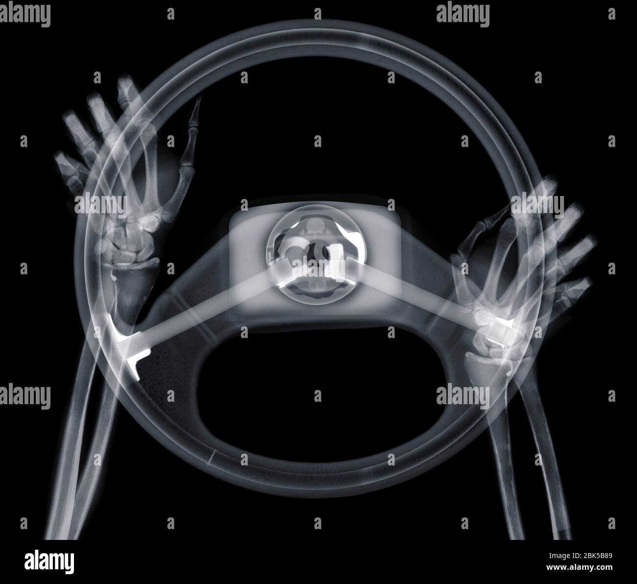 Human hands on steering wheel, X-ray. Stock Photo