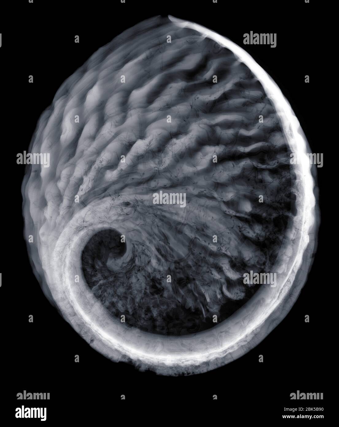 Underneath of a sea shell, X-ray. Stock Photo