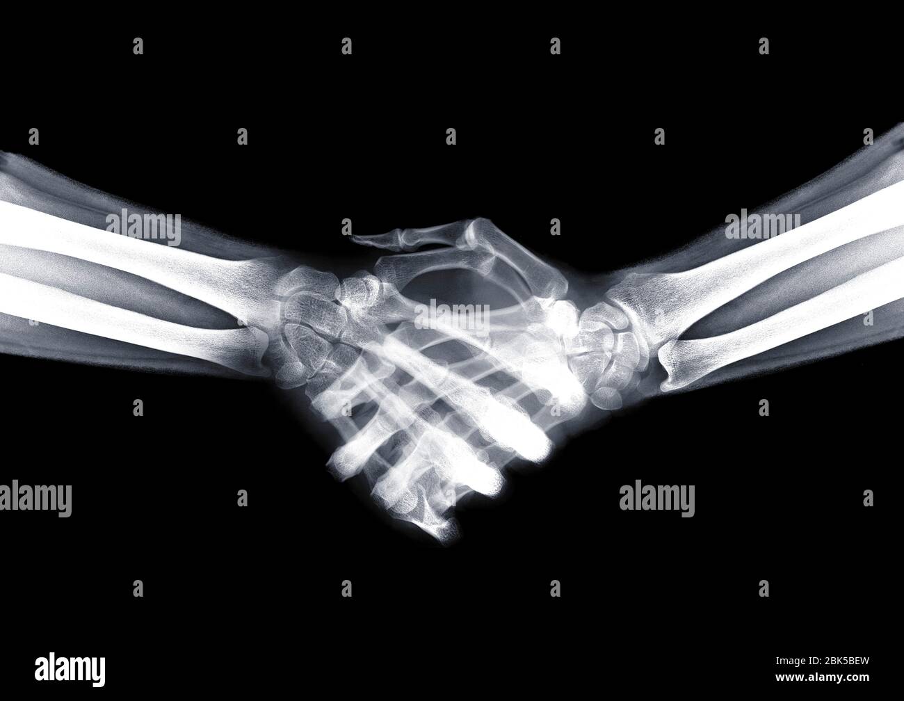 Handshake, X-ray. Stock Photo