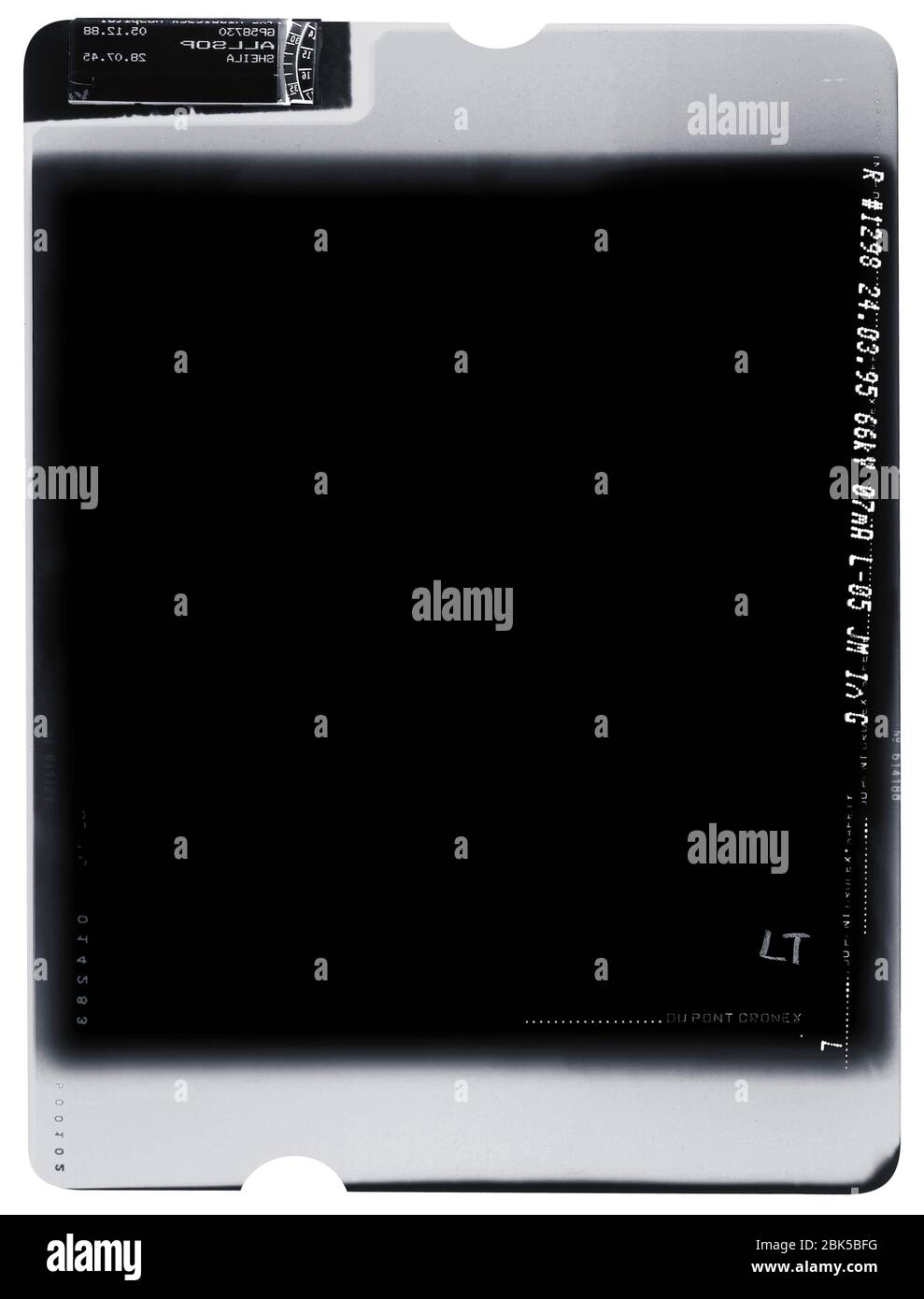 Xray film, Xray Stock Photo Alamy