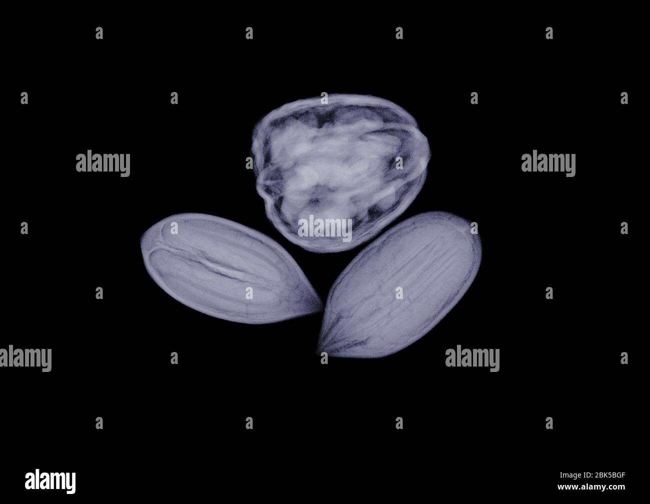 Assorted nuts, X-ray. Stock Photo
