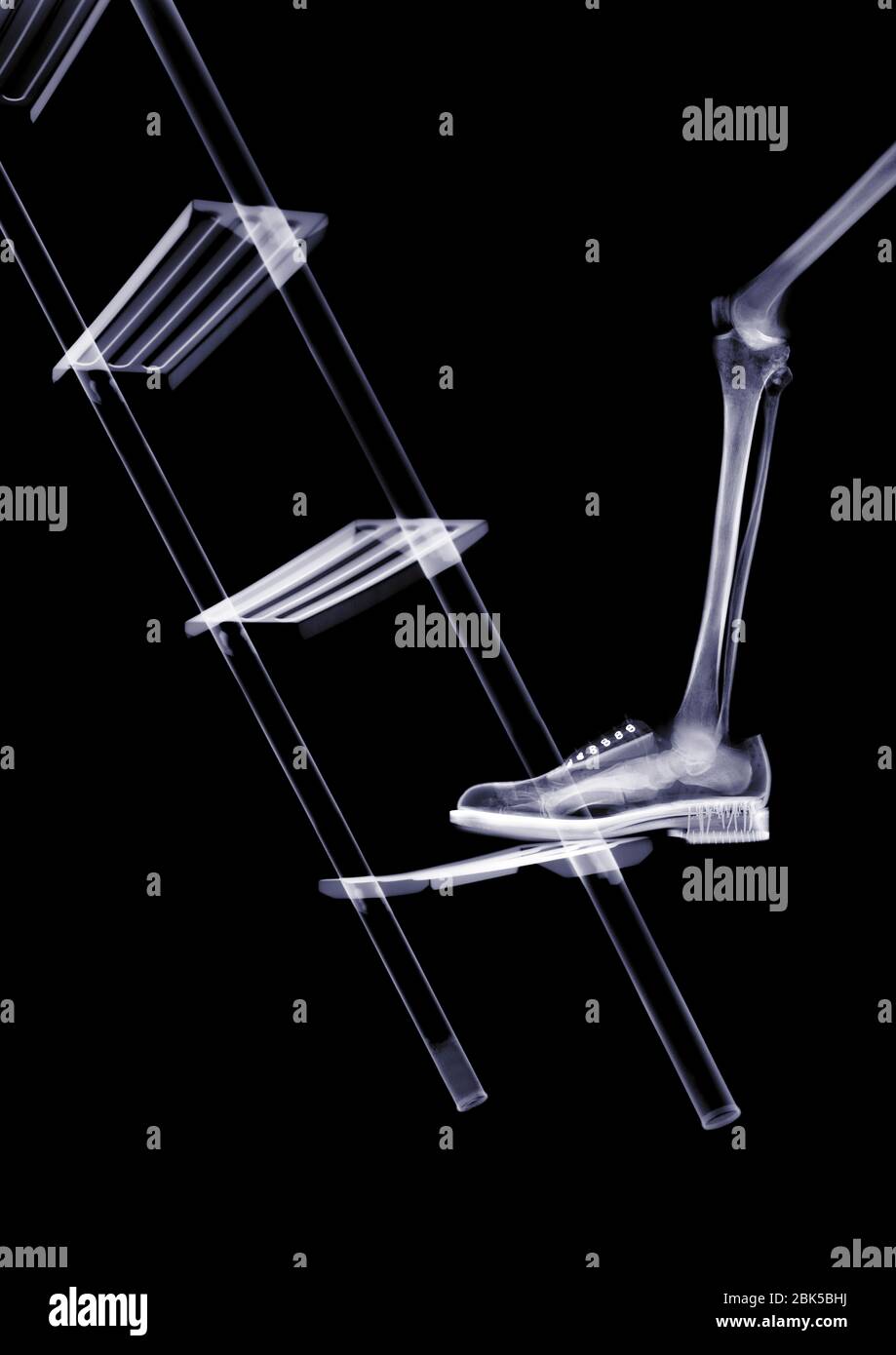 Foot stepping on the first rung of a ladder, X-ray. Stock Photo