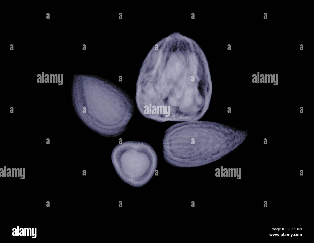 Assorted nuts, X-ray. Stock Photo