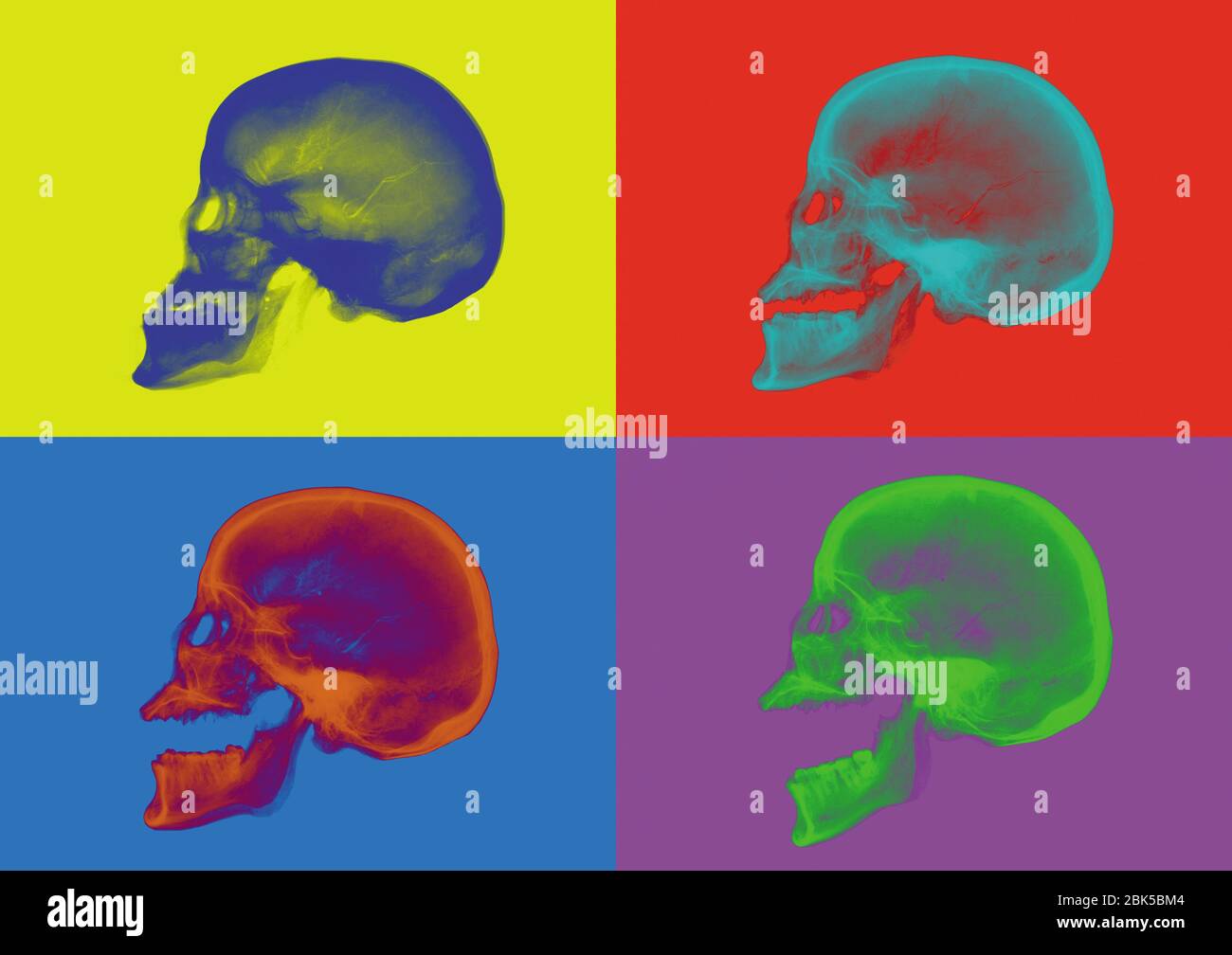 Four skulls against coloured backgrounds, coloured X-ray. Stock Photo