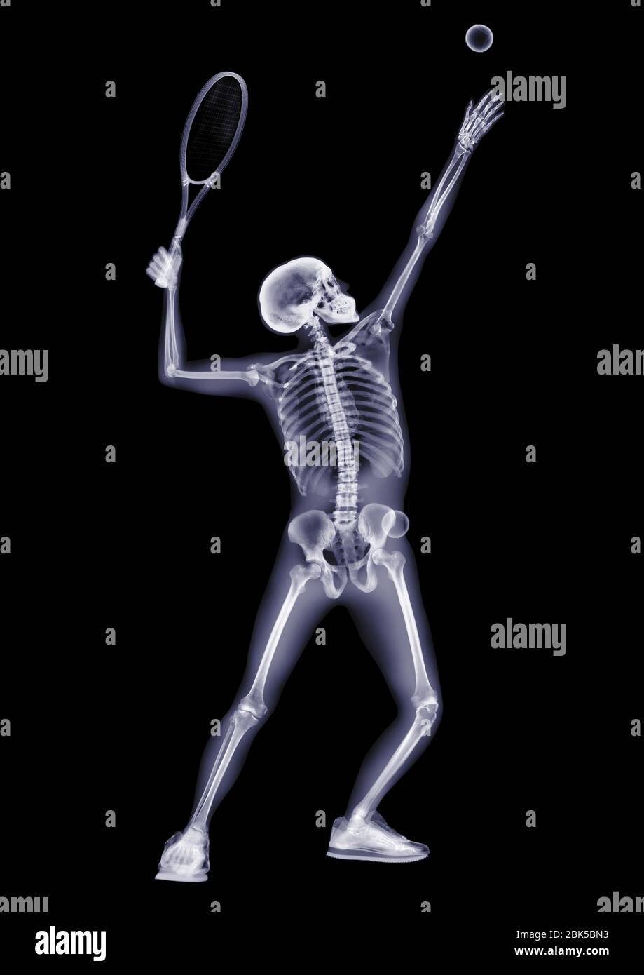 Person serving tennis ball, Xray Stock Photo Alamy