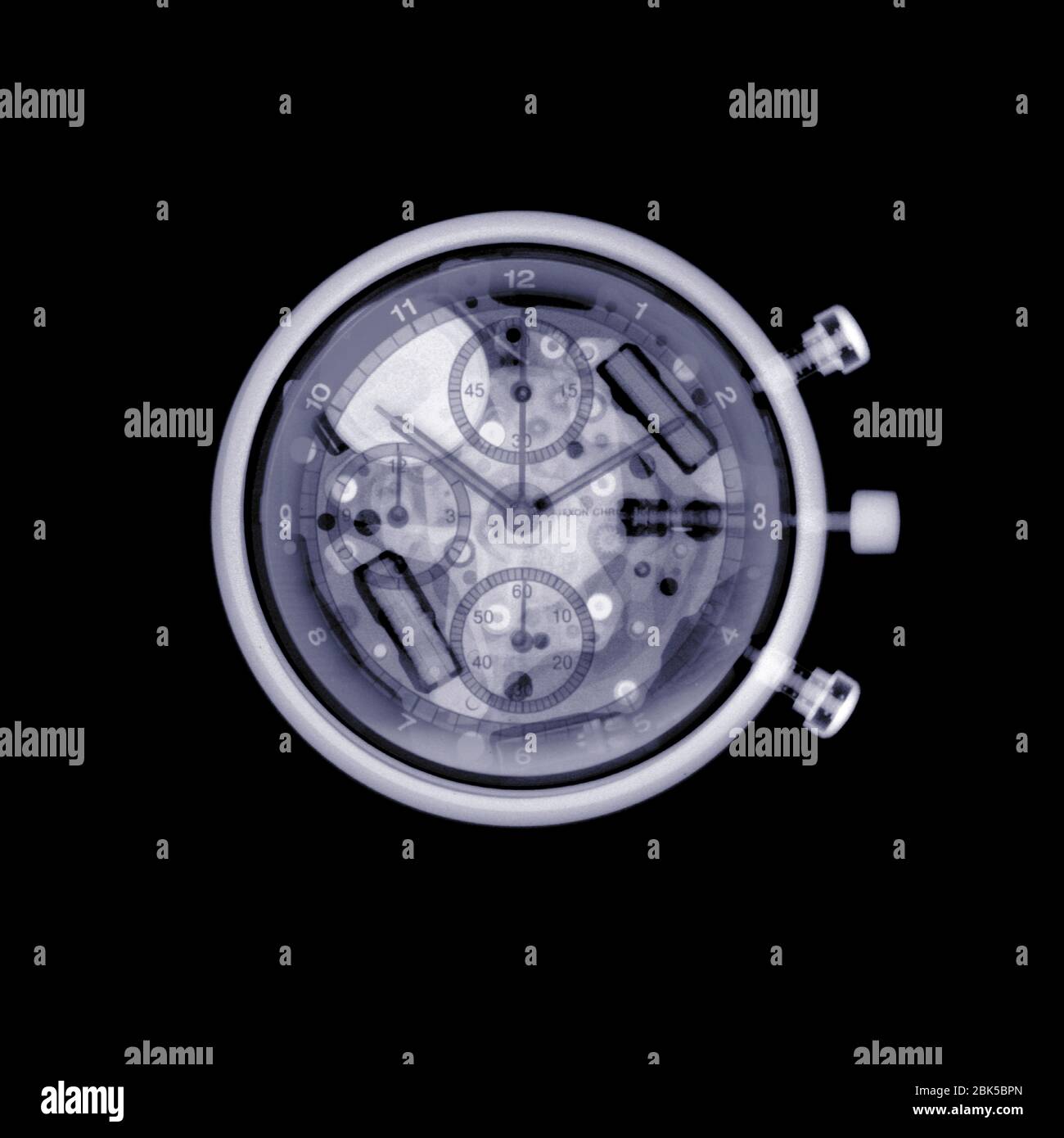 Stopwatch, X-ray. Stock Photo