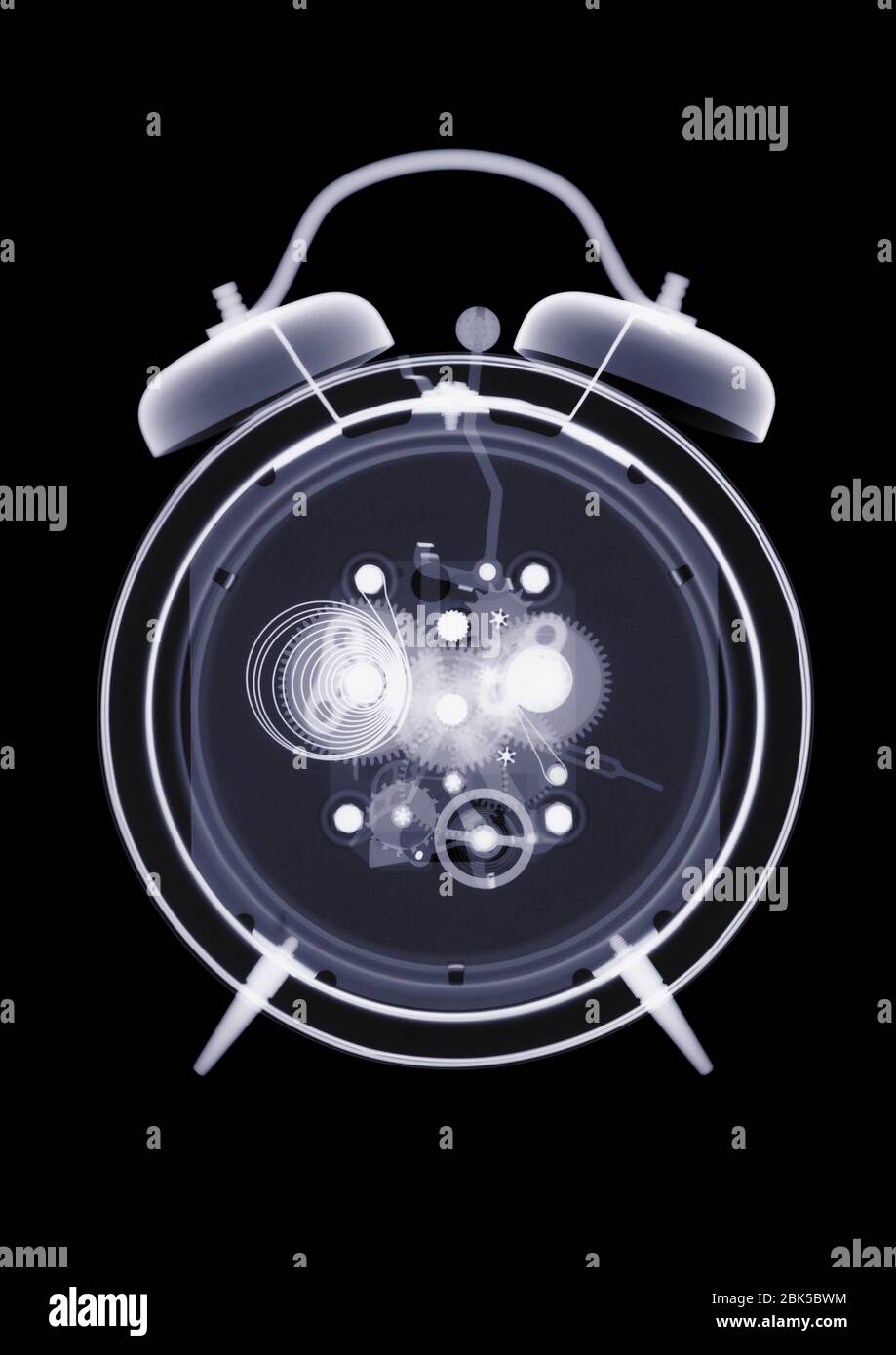 Alarm clock, X-ray. Stock Photo