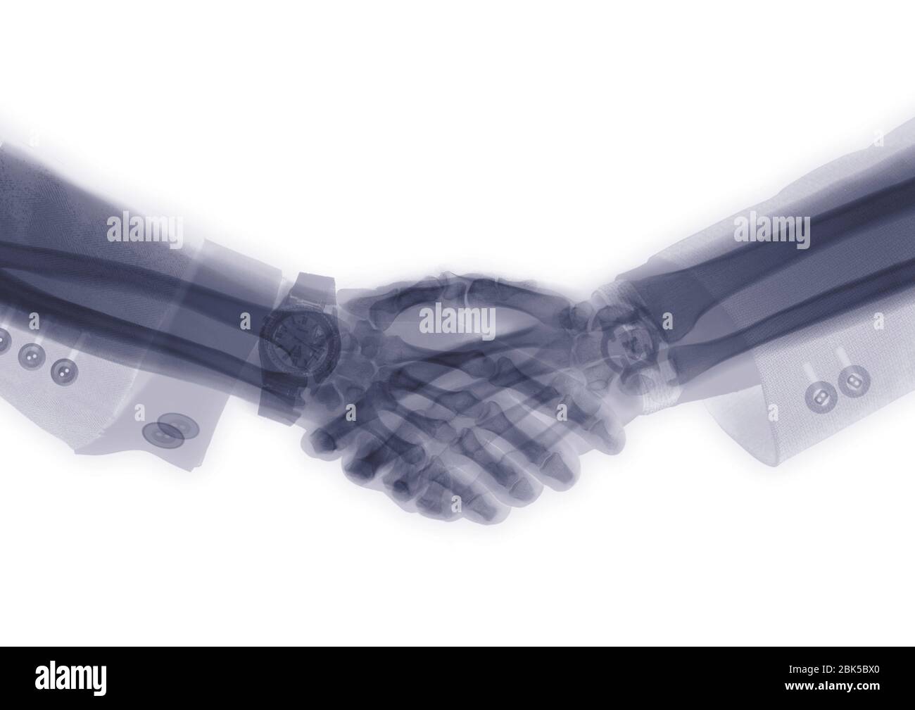 Two executive shaking hands, X-ray. Stock Photo