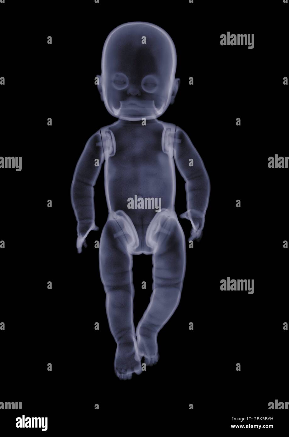 Baby doll, X-ray. Stock Photo