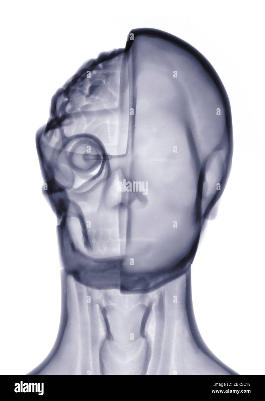 Anatomical model, X-ray. Stock Photo