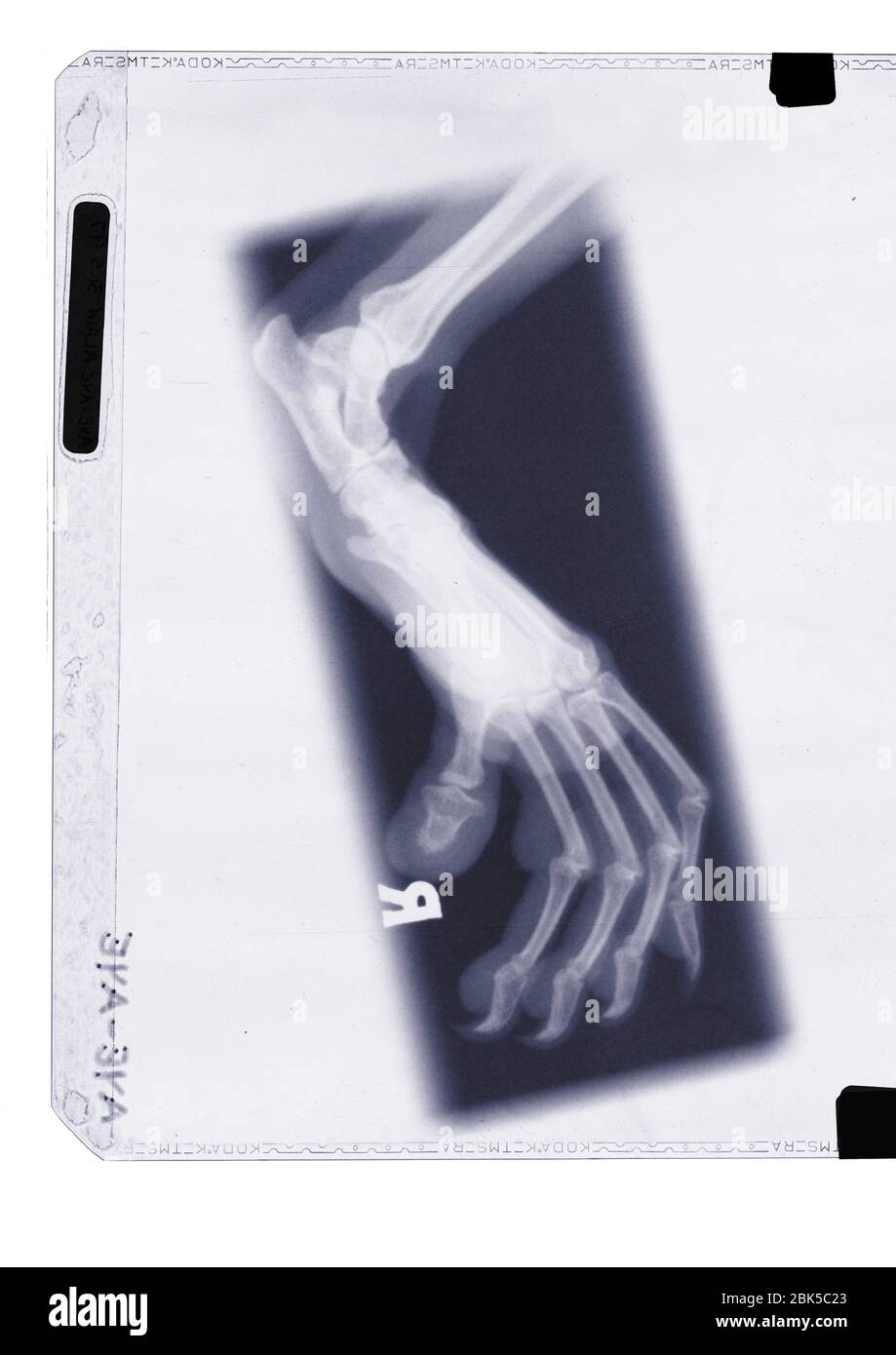 Animal claw, X-ray. Stock Photo
