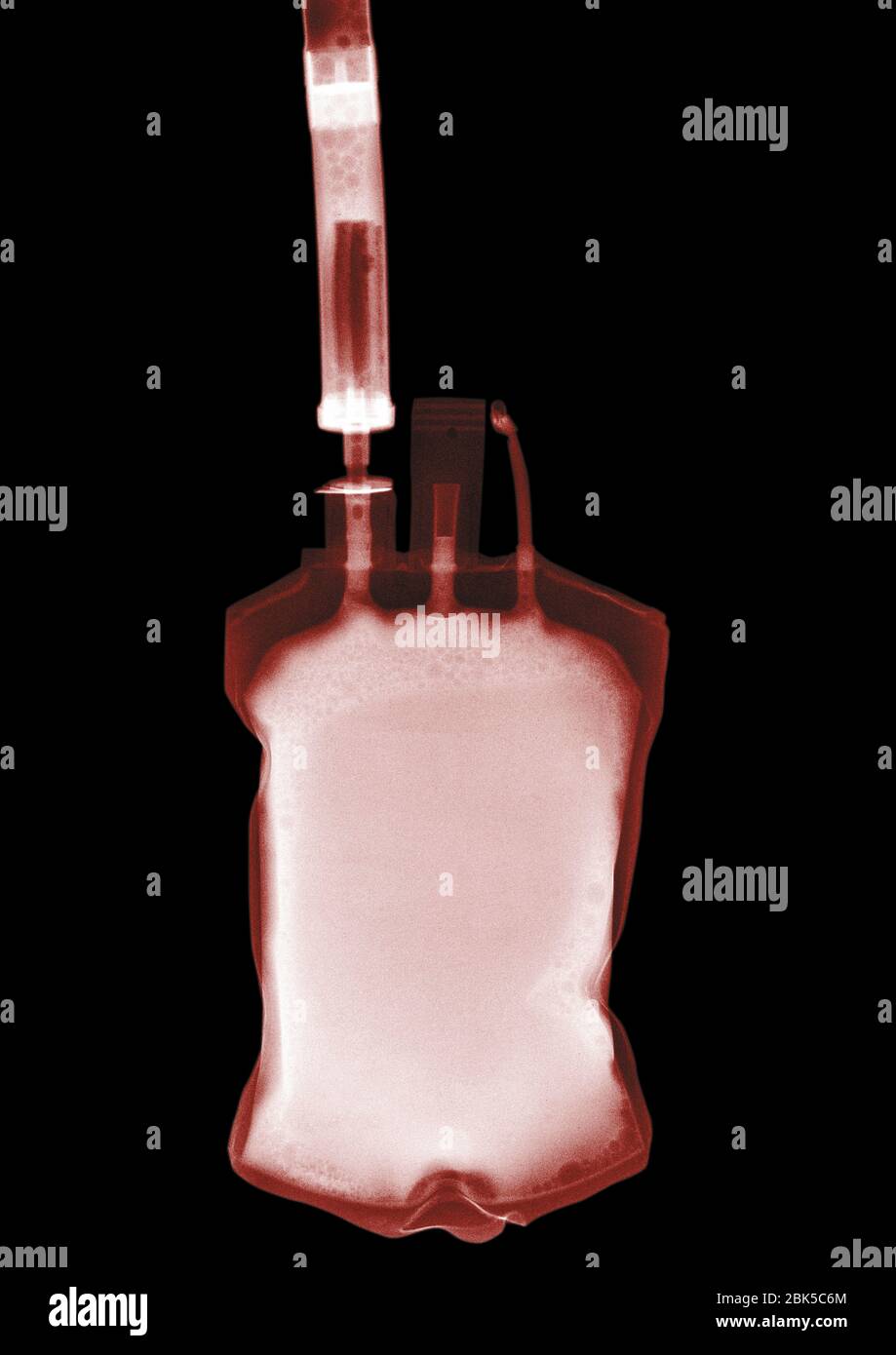 Bag filled with blood, coloured X-ray. Stock Photo