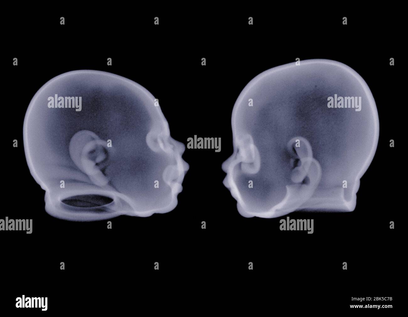Two doll heads, X-ray. Stock Photo
