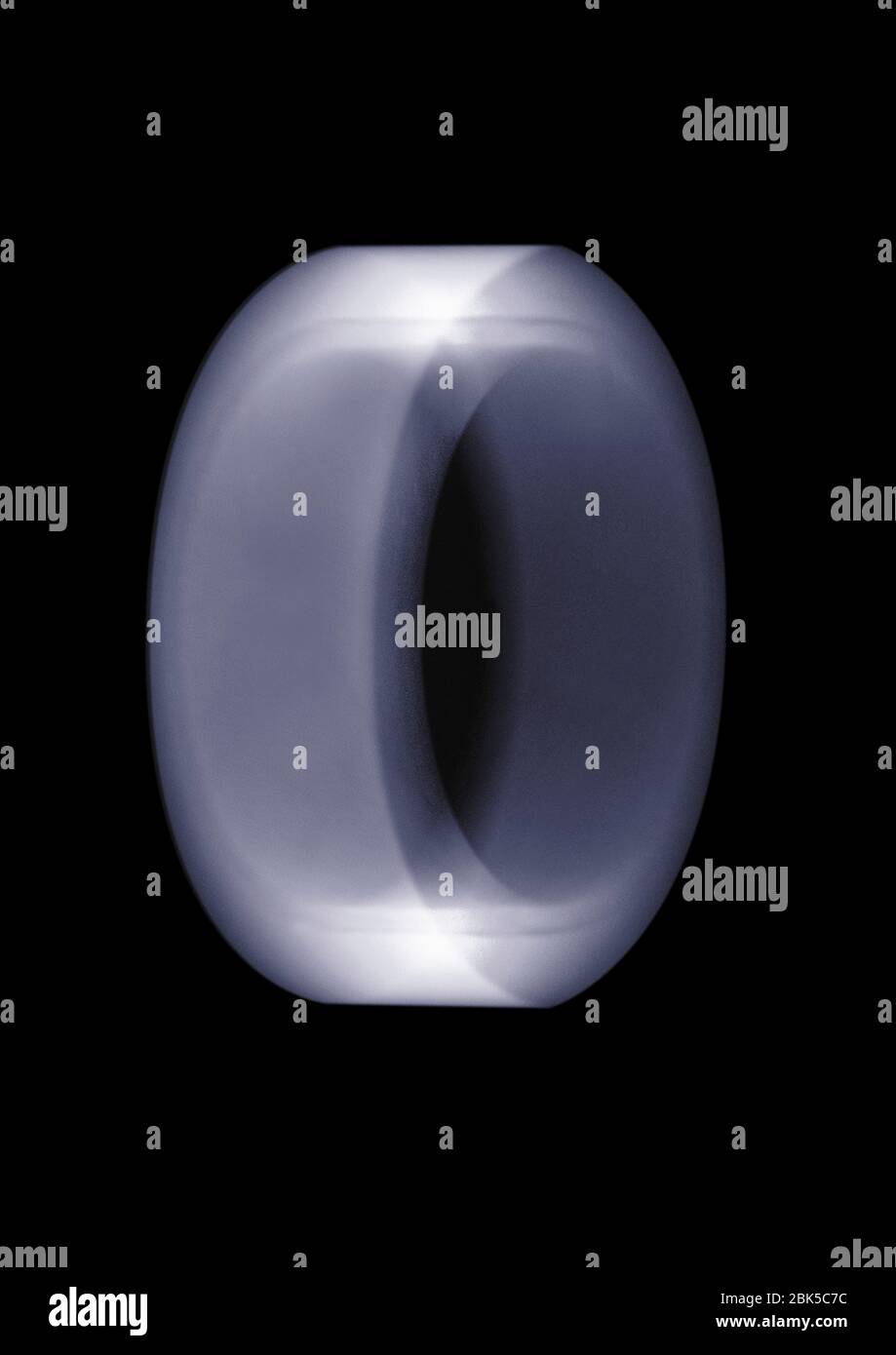 Metal ring, X-ray. Stock Photo