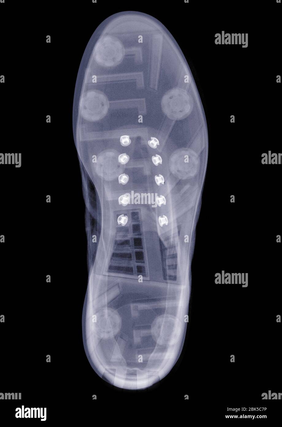 Shoe sole, X-ray. Stock Photo