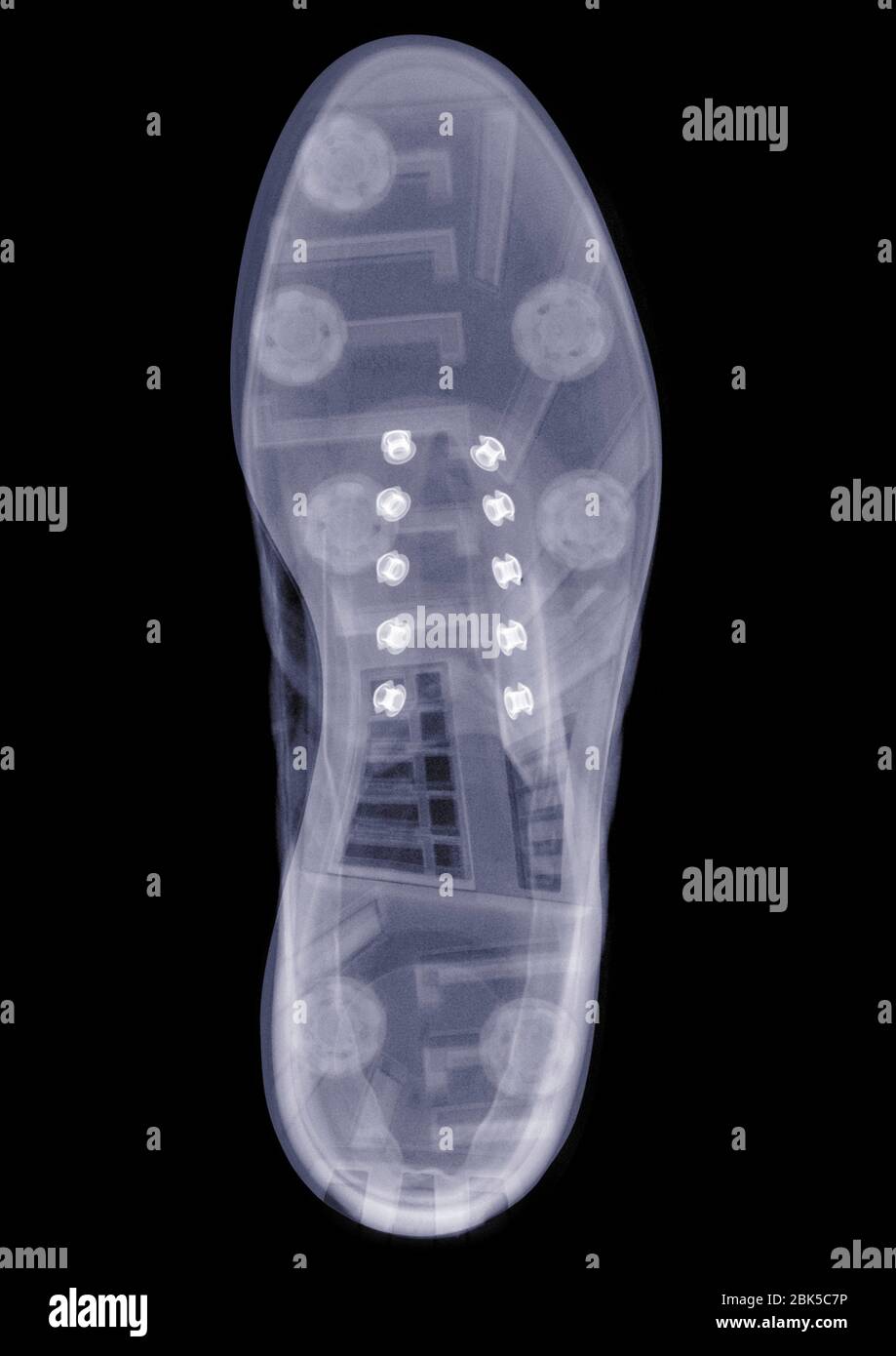 Foot xray and shoe hires stock photography and images Alamy