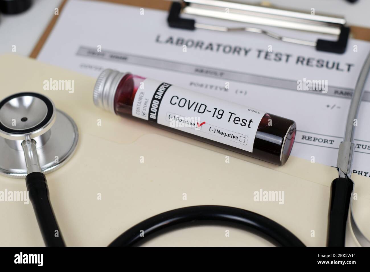 Download Covid 19 Coronavirus Test Result Mock Up Concept Illustrative Image With Vial Tube And Print Out Stock Photo Alamy PSD Mockup Templates