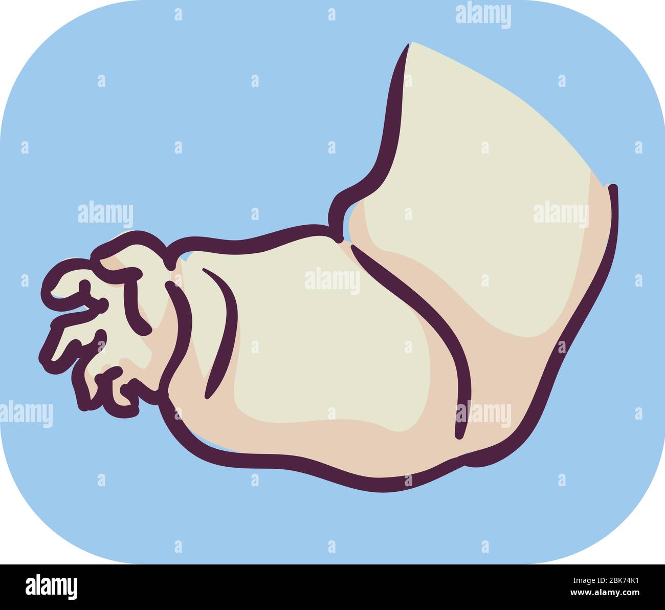 Illustration of Swollen Arm Symptom of Edema Stock Photo