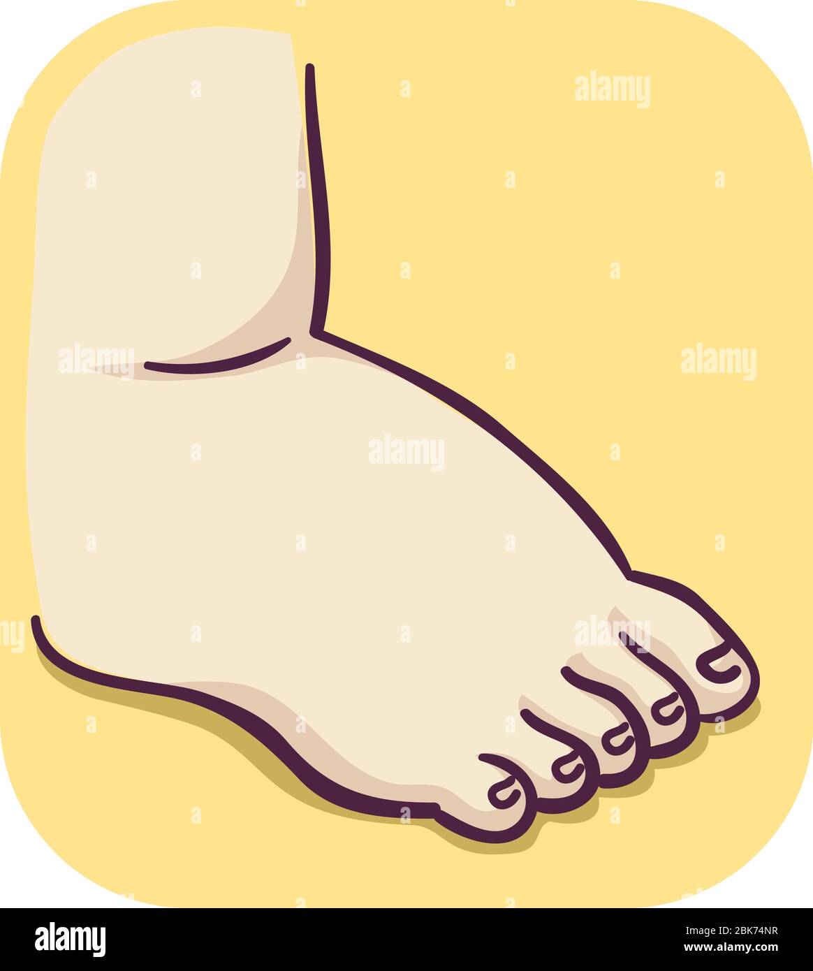 Swollen Foot High Resolution Stock Photography and Images Alamy