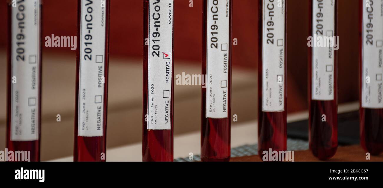 a close-up view of COVID-19 a.k.a 2019-nCov hispeed blood test samples ...