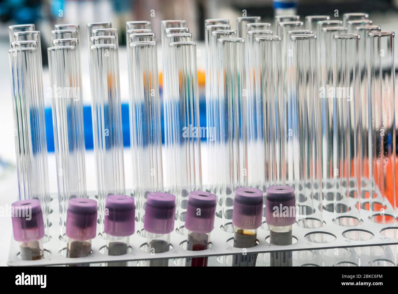 Test tubes in a laboratory, conceptual image Stock Photo - Alamy