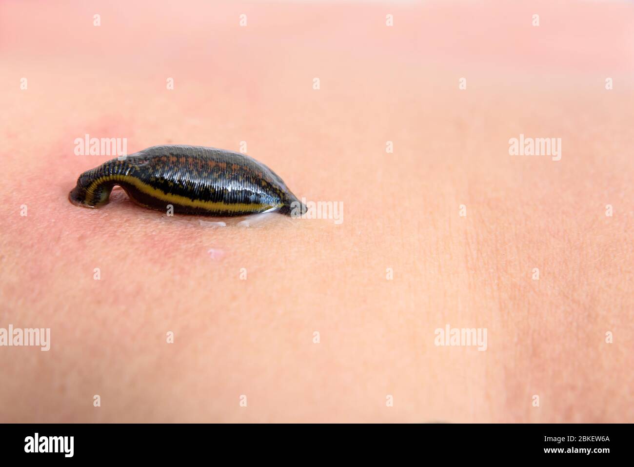 Tropical land leech sucking some blood from the skin Stock Photo - Alamy