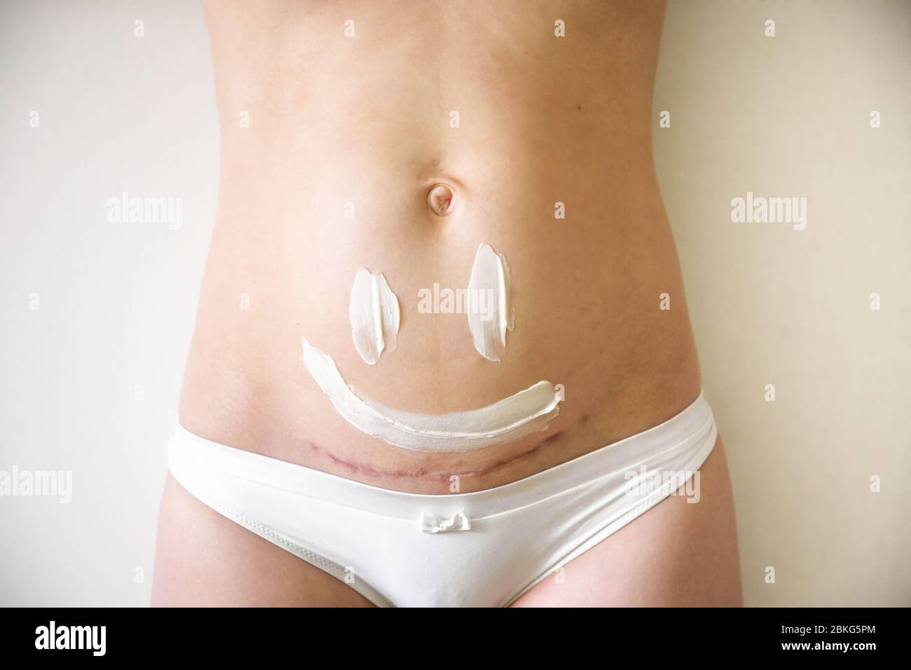 Closeup of woman belly with a scar from a cesarean section and of cosmetic cream on skin Stock Photo