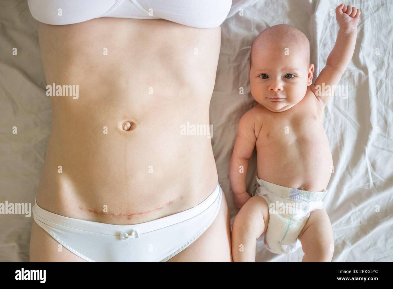 Closeup of woman belly with a scar from a cesarean section and her baby near Stock Photo