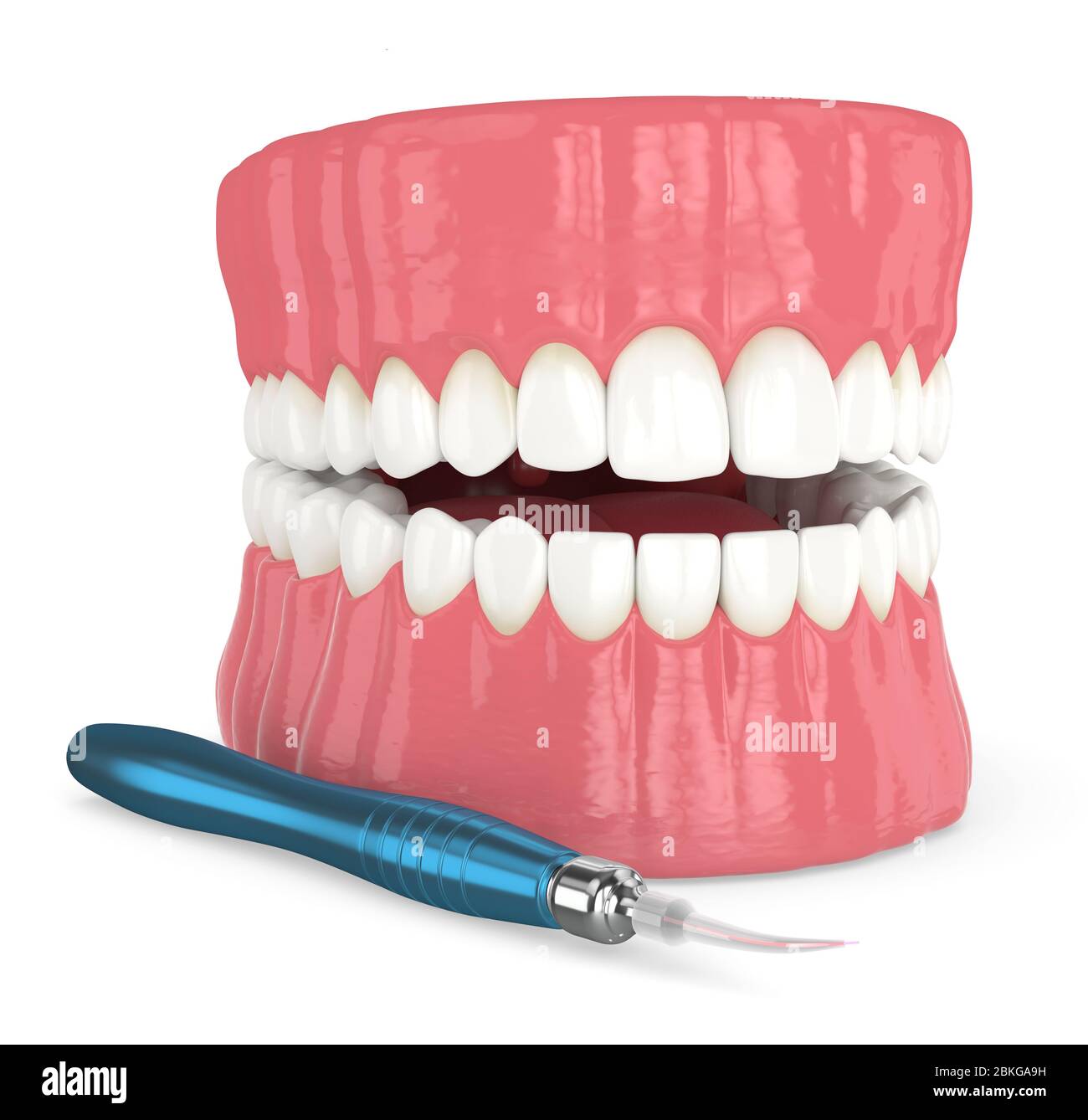 3d render of dental diode laser used to treat gums. The concept of using  laser therapy in the treatment of gums Stock Photo - Alamy