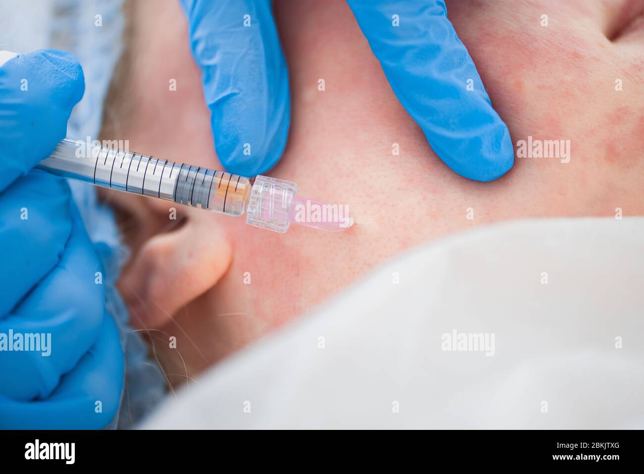 Injection cosmetology. Doctor makes an injection into the skin of the ...