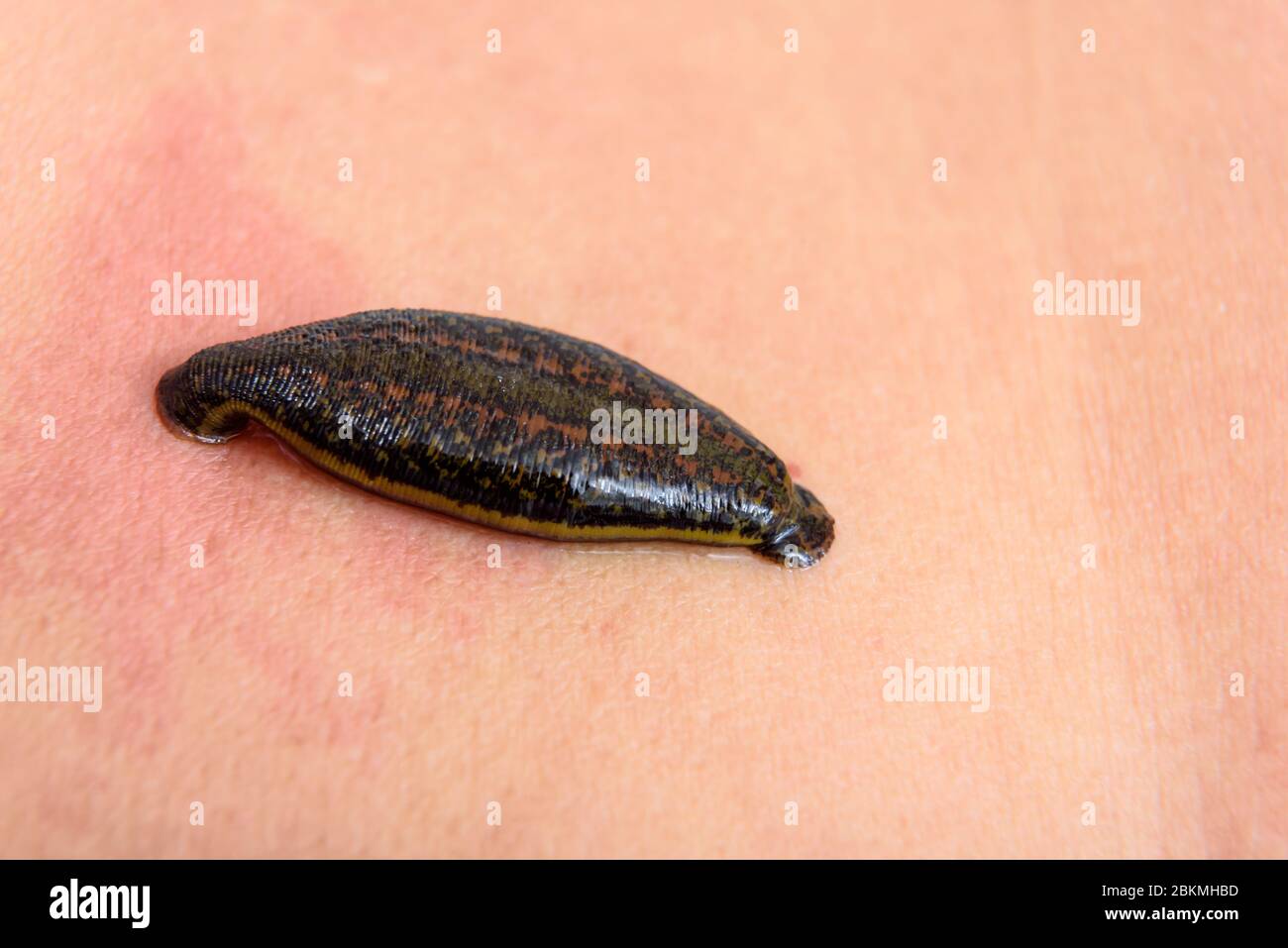 Tropical land leech sucking some blood from the skin Stock Photo - Alamy