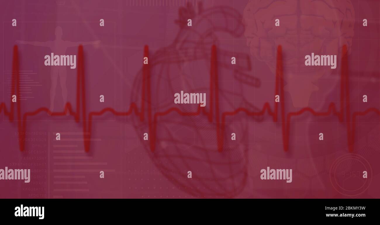 Digital illustration of a heartbeat monitor over a heart medical book