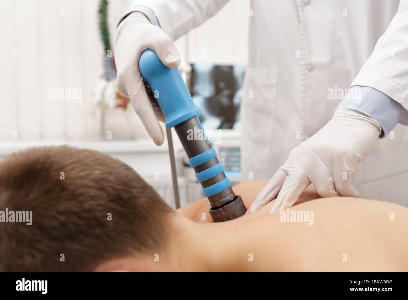 Extracorporeal Shockwave Therapy ESWT.Non-surgical treatment.Physical  therapy for neck and back muscles,spine with shock waves.Pain relief Stock  Photo - Alamy