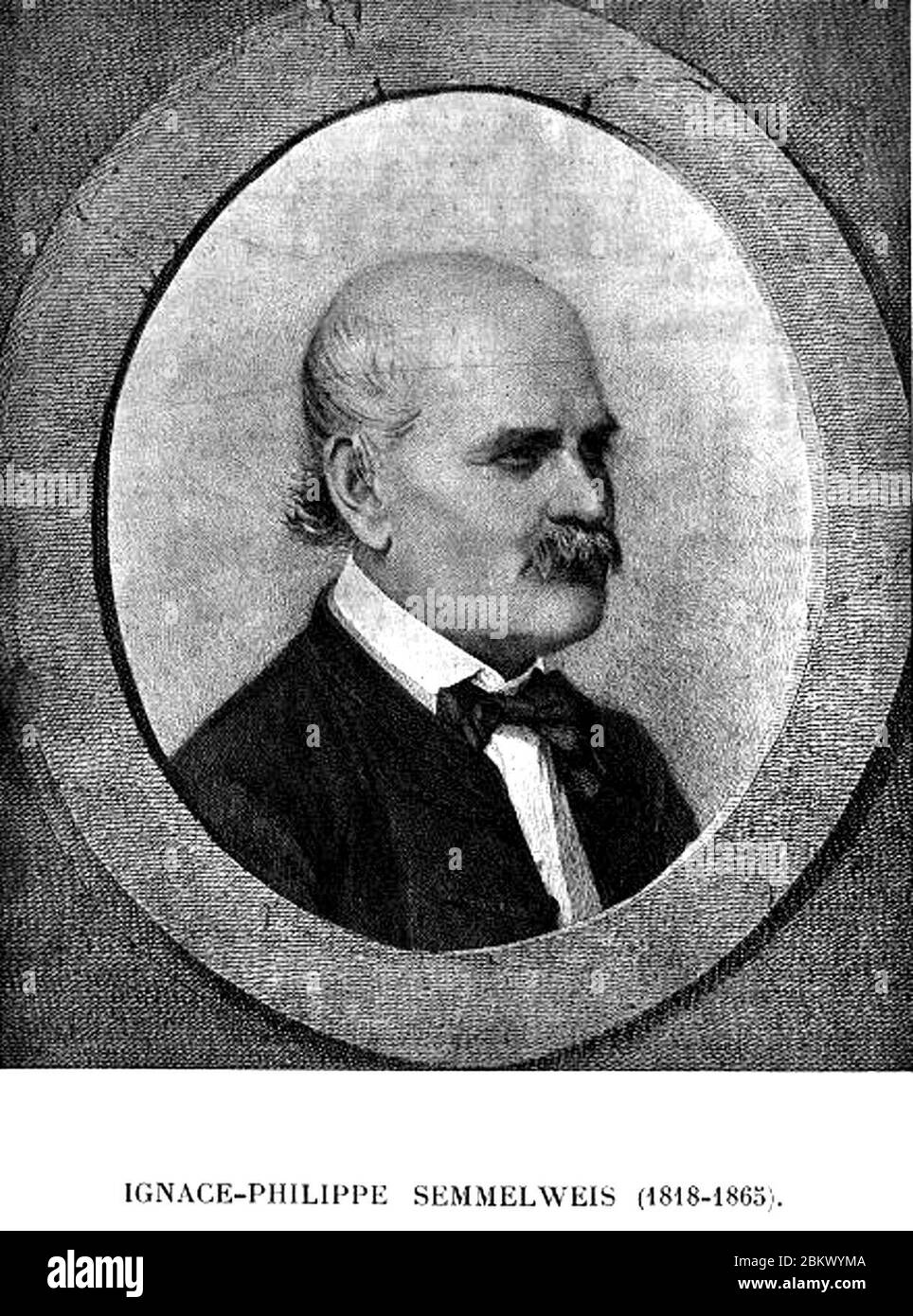 IgnacePhilippe Semmelweis (18181865 Stock Photo Alamy