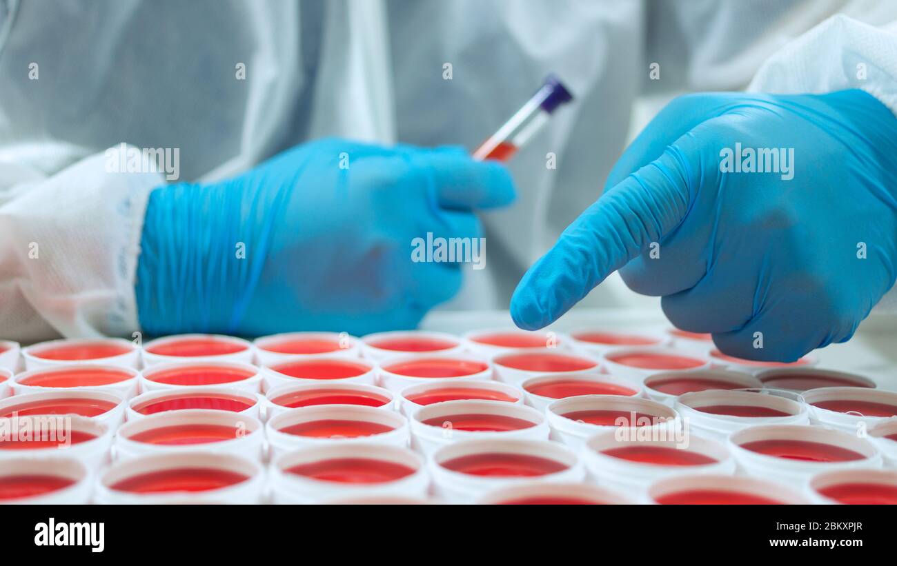 Close up view of doctor in blue glove pointing his finger at a group of round red clinical specimens on a white surface. With his other hand he holds Stock Photo