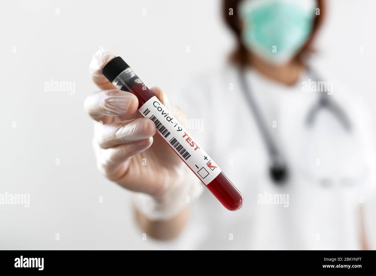 Np Test Postive Nurse holding specimen tube hi-res stock photography and images - Alamy