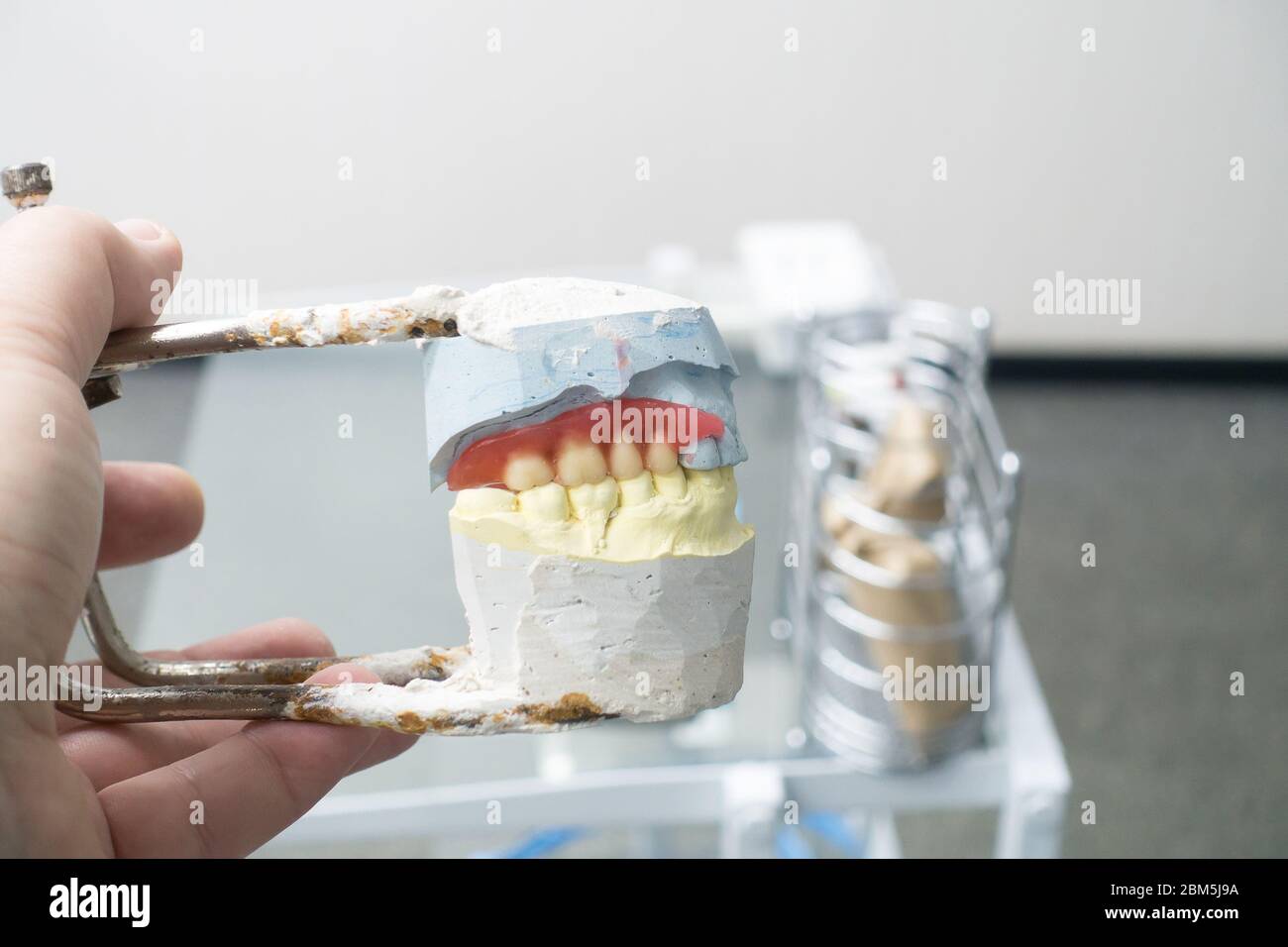 wax preparations of removable dentures on a plaster model Stock Photo
