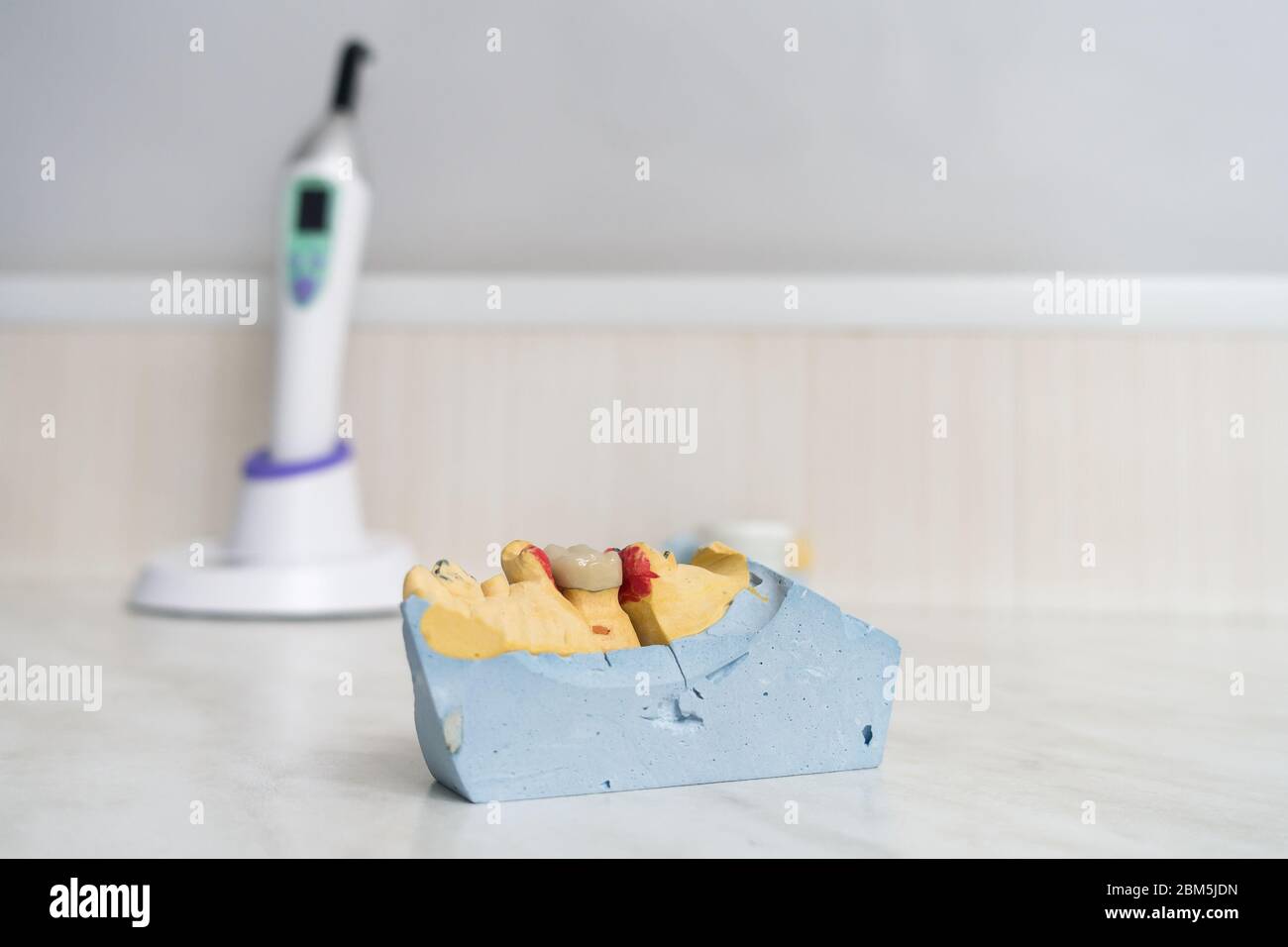 dental ceramic crown on a plaster model stands on a table Stock Photo