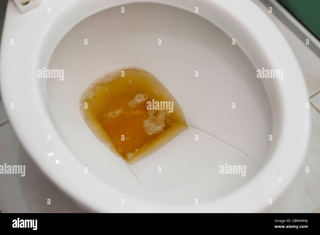 bathroom toilet with dark colored urine Stock Photo - Alamy