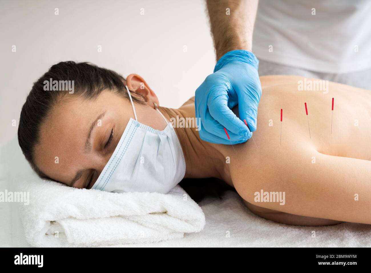Acupuncture Skin Treatment For Women In Face Mask Stock Photo
