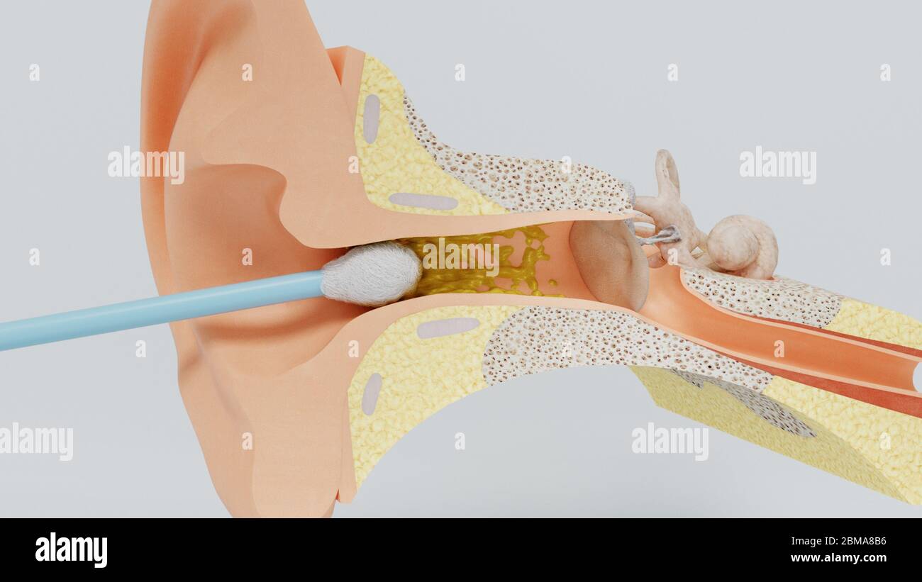 Cochlear shell hi-res stock photography and images - Alamy